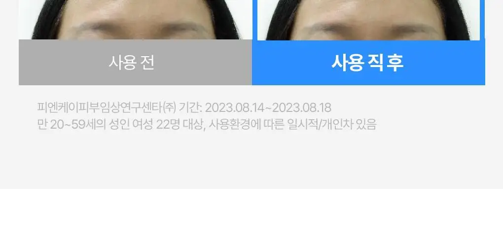 [지현우 PICK] 메디올 두피 케어 에어 세럼 상세페이지 11
